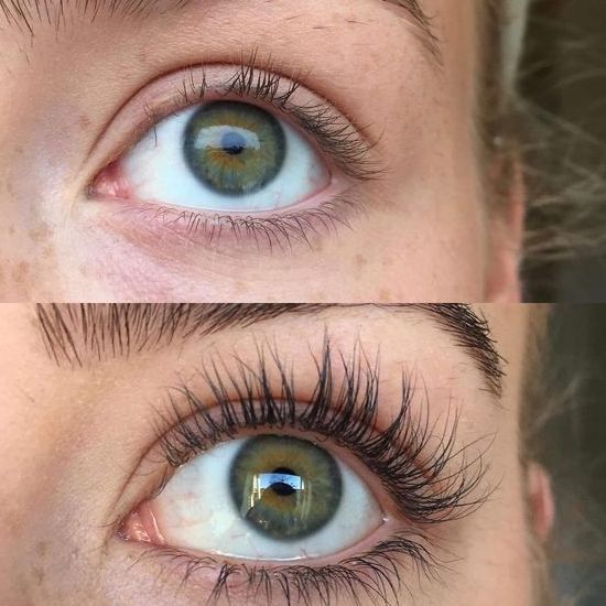 Yovria LashBoost 7X – Natural Eyelash Growth Serum